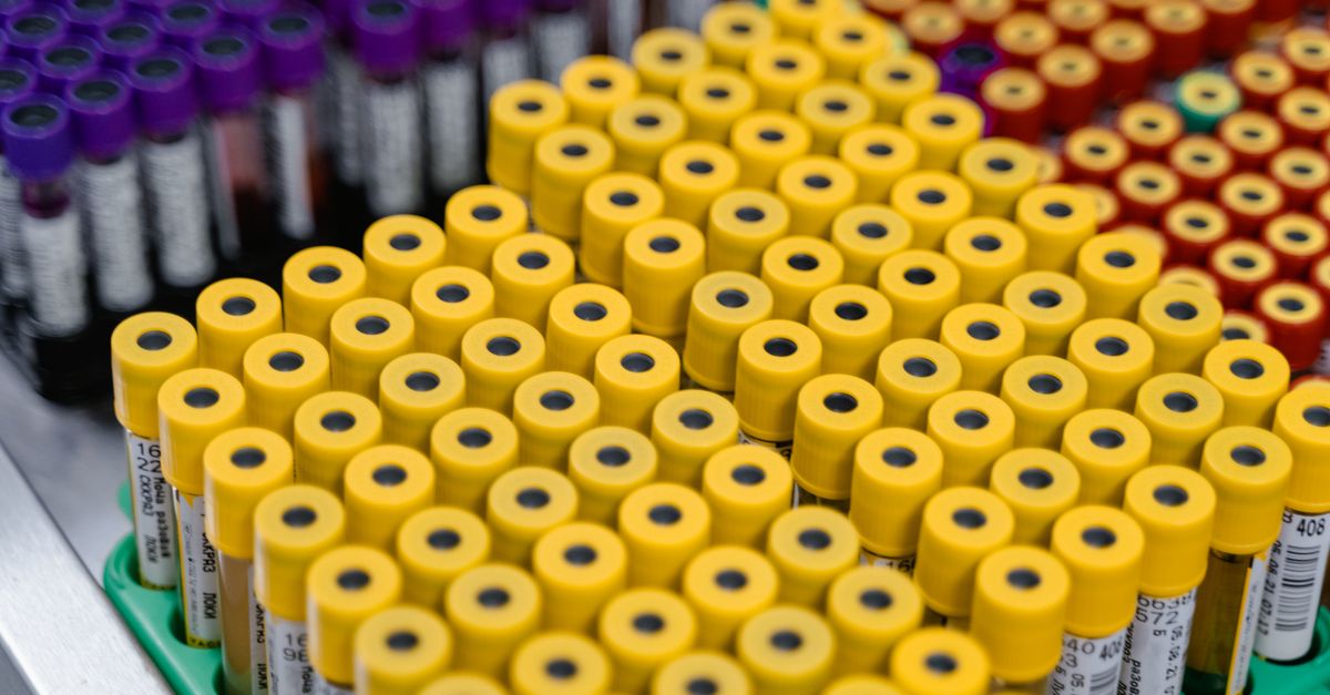 Biotechnology Roundup: Scribe IPO Prices High, China Gene-Editing Trial Death Draws Scrutiny, Japan Advances Pig Kidney Program Close-up image of multiple test tubes in a laboratory setting displaying different colored caps.