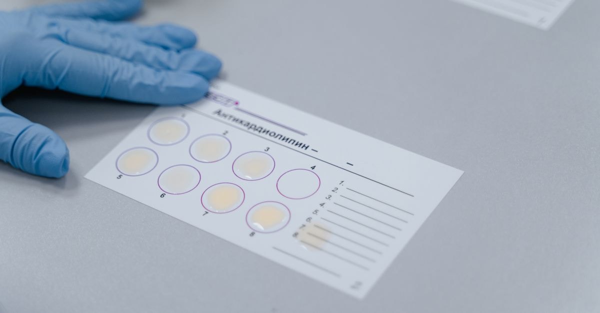 Amazon's AWS Surge Lifts Q2 Results as Capex Climbs to $220B and AGI Lab Shuts Lab test result form with gloved hand, indicating a scientific experiment setup.