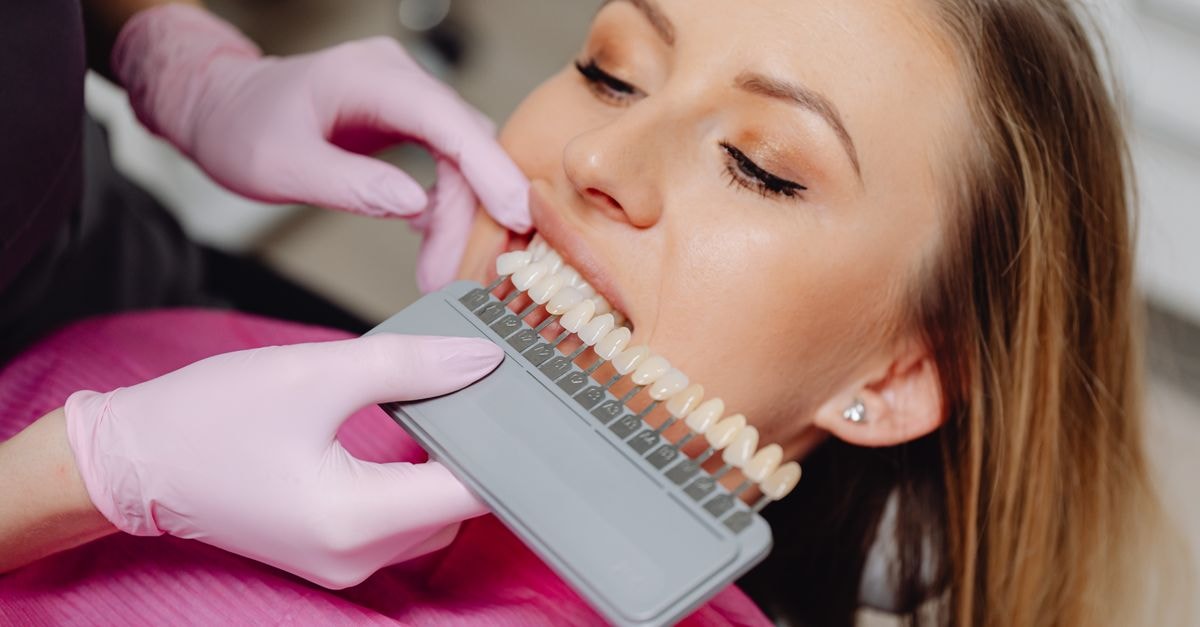 Dental shade guide being used to match tooth color during a hygiene procedure.